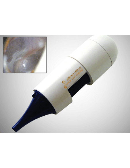 EarScope Basic