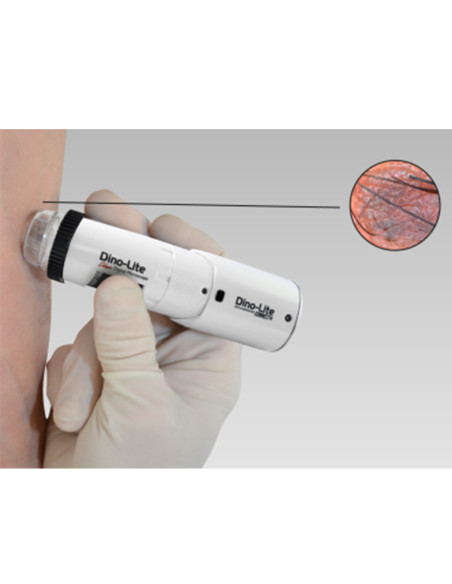 Wi-fi digital wireless dermatoscope