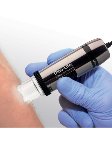 Dino-Lite Polarizer HR digital dermatoscope
