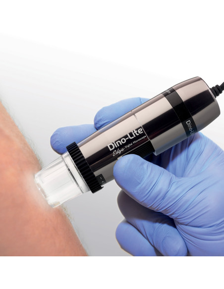 Dino-Lite Polarizer HR digital dermatoscope