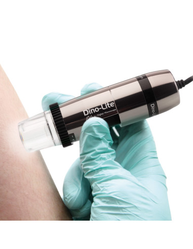 Dino-Lite Polarizer HR digital dermatoscope