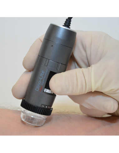 Dino-Lite Polarizer digital dermatoscope