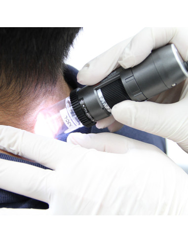 Dino-Lite Polarizer digital dermatoscope