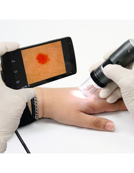 Dino-Lite Polarizer digital dermatoscope