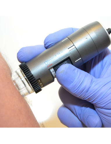 Dino-Lite Polarizer digital dermatoscope