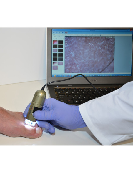 Dino-Lite Digital Podoscope