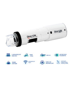 Wi-fi digital wireless capillaroscope