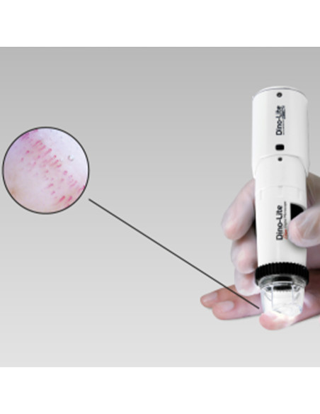 Wi-fi digital wireless capillaroscope