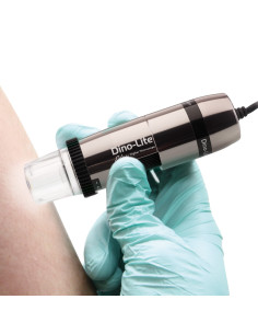 Dino-Lite Polarizer HR digital dermatoscope 2